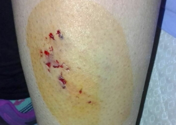 Denuncian que perros atentan contra los vecinos de Totoras