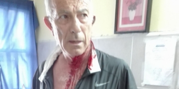 Atacaron a golpes al presidente comunal de Pueblo Andino