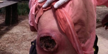 Impactante: rescataron a un anciano en zona de islas con una tremenda herida