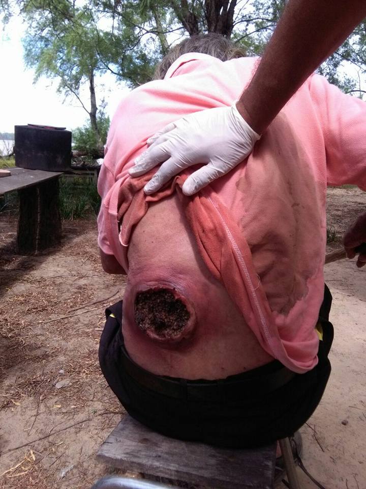 Impactante: rescataron a un anciano en zona de islas con una tremenda herida