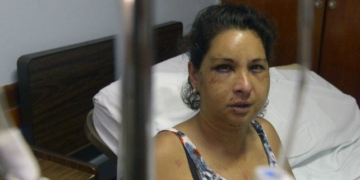 «Vi la muerte»: el desgarrador relato de la mujer salvajemente golpeada en Díaz