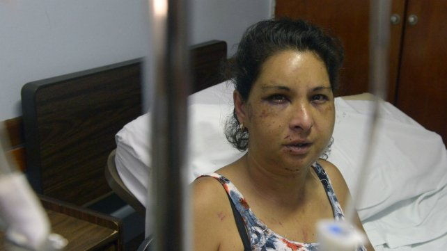 “Vi la muerte”: el desgarrador relato de la mujer salvajemente golpeada en Díaz