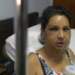 «Vi la muerte»: el desgarrador relato de la mujer salvajemente golpeada en Díaz