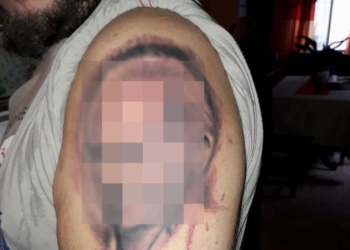 Insólito: se tatuó la cara de un intendente de la región