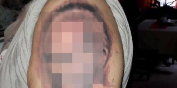 Insólito: se tatuó la cara de un intendente de la región