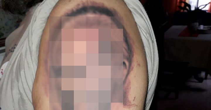 Insólito: se tatuó la cara de un intendente de la región