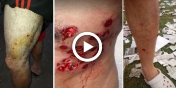 Videos: hinchas de Timbuense denunciaron una «salvaje represión»