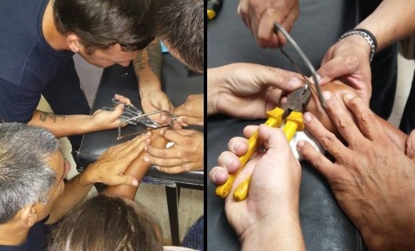 Bomberos realizaron una quirúrgica maniobra para ayudar a una joven