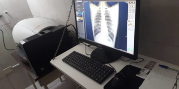 El Samco de San Genaro ya cuenta con aparato digital de rayos