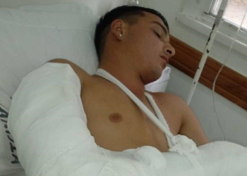 Buscan testigos de un accidente que dejó malherido a un joven en la región