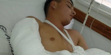 Buscan testigos de un accidente que dejó malherido a un joven en la región