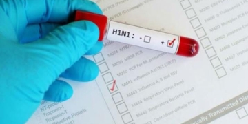 Luego del fallecimiento de dos personas, negaron epidemia por gripe «A»