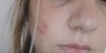 Imputaron y liberaron al agresor de la mujer de San Genaro