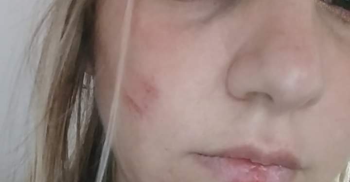 Imputaron y liberaron al agresor de la mujer de San Genaro