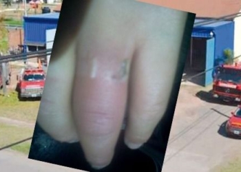 Con una amoladora, bomberos de Oliveros le salvaron el dedo a una nena
