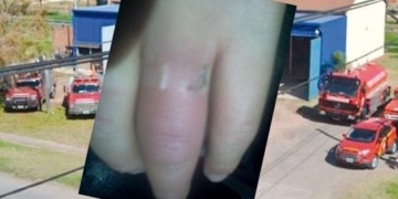 Con una amoladora, bomberos de Oliveros le salvaron el dedo a una nena