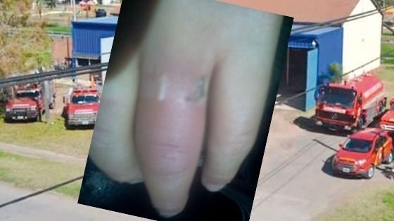 Con una amoladora, bomberos de Oliveros le salvaron el dedo a una nena