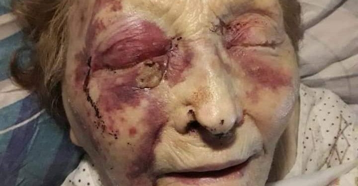 Imputaron y liberaron a la empleada que atacó a una abuela