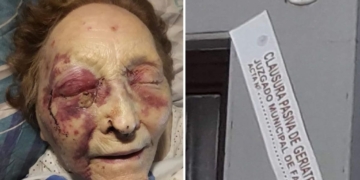 Golpearon salvajemente a una abuela en un geriátrico de la región