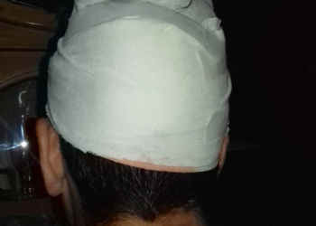 Un joven de San Genaro fue sorprendido en su casa y agredido con una piedra en su cabeza