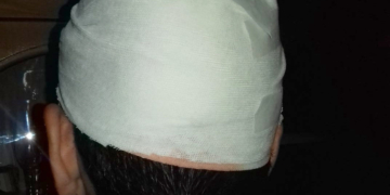 Un joven de San Genaro fue sorprendido en su casa y agredido con una piedra en su cabeza