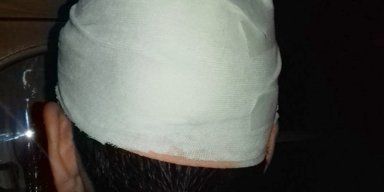 Un joven de San Genaro fue sorprendido en su casa y agredido con una piedra en su cabeza