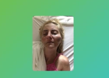 Una mujer hospitalizada tras ser atacada por un cuidacoches