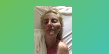 Una mujer hospitalizada tras ser atacada por un cuidacoches