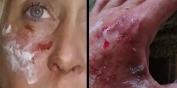 Una remisera fue brutalmente atacada a la vera de la autopista