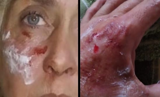 Una remisera fue brutalmente atacada a la vera de la autopista
