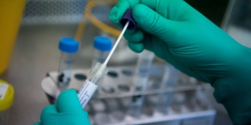 11 casos nuevos de coronavirus en Santa Fe, más de 100 a nivel país y dos fallecidos