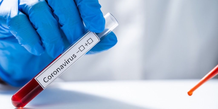 Los casos estudiados en Monje y San Genaro dieron negativos por coronavirus