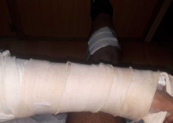 Gaboto: un operativo terminó con un oficial de Los Pumas herido