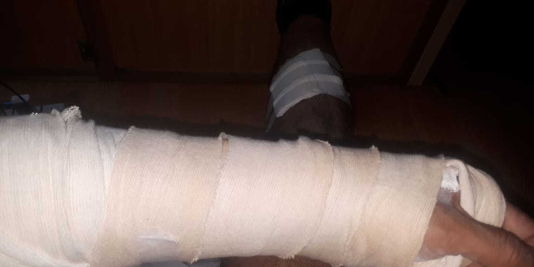 Gaboto: un operativo terminó con un oficial de Los Pumas herido