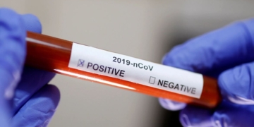 En un día se sumaron cinco nuevos casos de coronavirus en la región