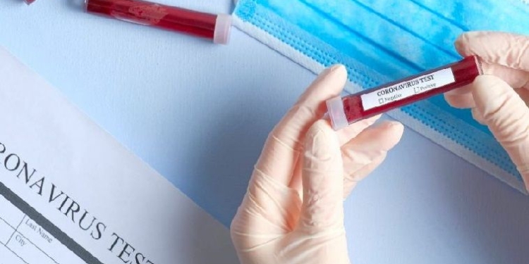 Dos nuevos casos de coronavirus positivo en la provincia y 69 a nivel nacional