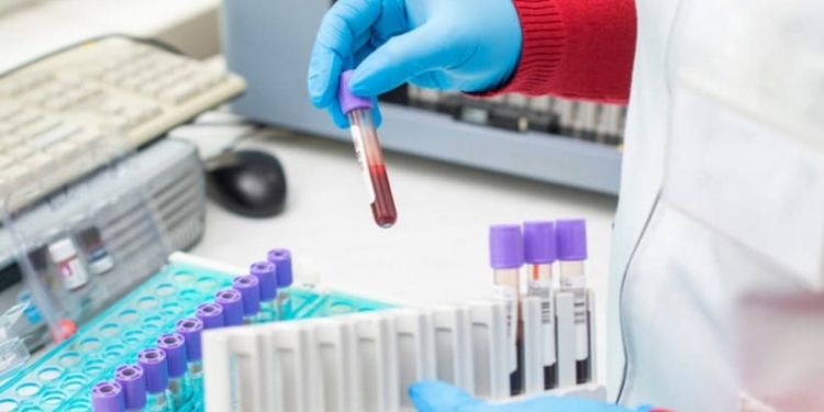 Covid-19: nuevos casos sospechosos en Monje, San Genaro y descartaron otro en Serodino