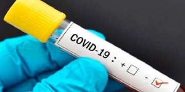 Los casos estudiados en Monje y San Genaro dieron negativos por coronavirus