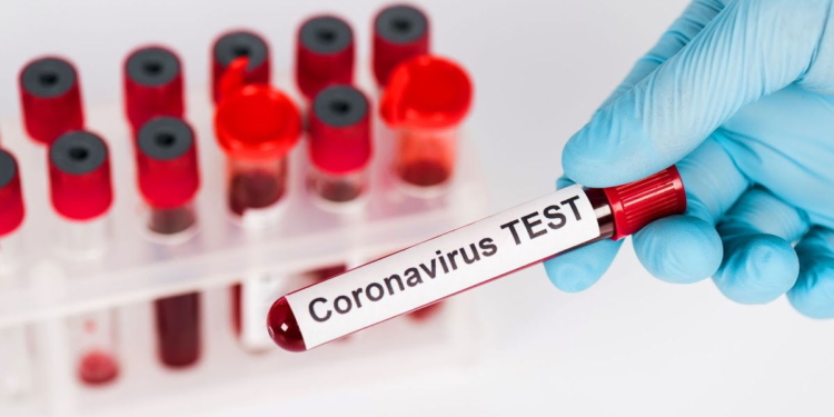 Parte oficial: los números de coronavirus en la provincia y la región
