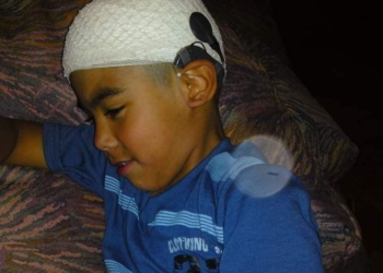 Un nene de Maciel necesita sus procesadores de sonido para volver a escuchar
