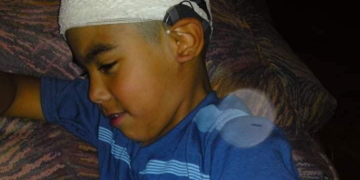 Un nene de Maciel necesita sus procesadores de sonido para volver a escuchar