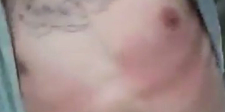 Timbúes: un joven denunció que fue agredido por personal de la Guardia Urbana