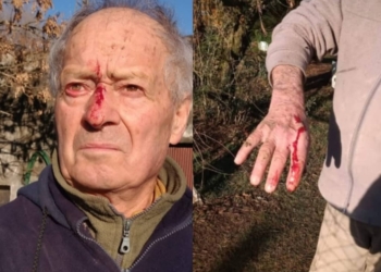 Brutal agresión: ingresaron a cazar a un campo y golpearon a dos abuelos