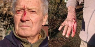 Brutal agresión: ingresaron a cazar a un campo y golpearon a dos abuelos