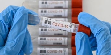 Santa Fe registró 944 casos nuevos de coronavirus este domingo