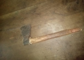 Fue atacado con un hacha en la región y lucha por su vida en el HECA