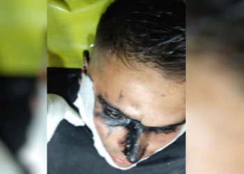 Arrojó pintura asfáltica en la cara a un policía para evitar ser detenido