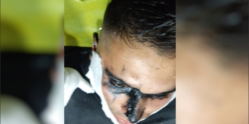 Arrojó pintura asfáltica en la cara a un policía para evitar ser detenido