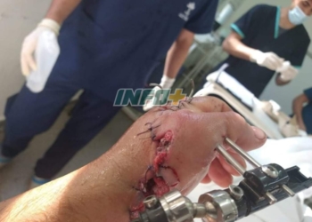 Violencia en Timbúes: un joven recibió un escopetazo tras una disputa familiar