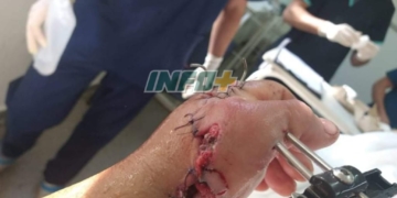 Violencia en Timbúes: un joven recibió un escopetazo tras una disputa familiar